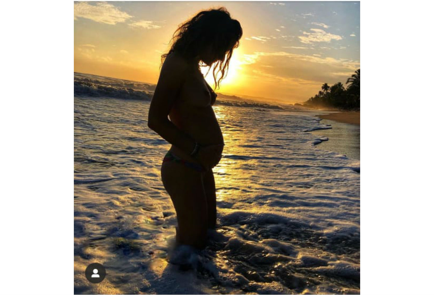 Naty Botero