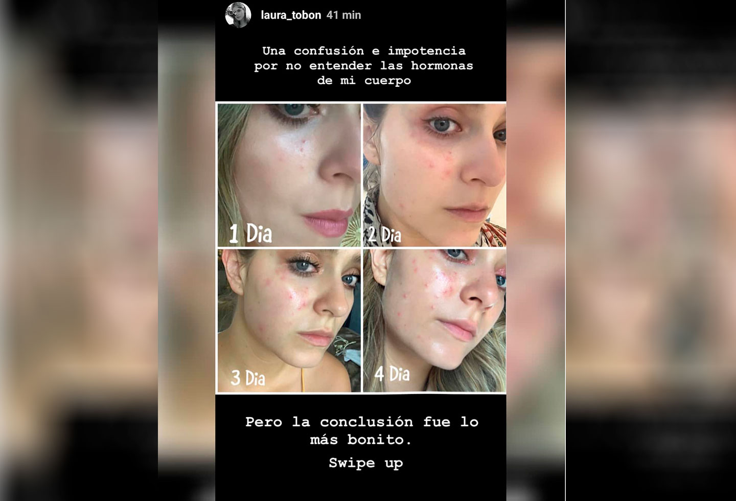 Cara de Laura Tobón afectada