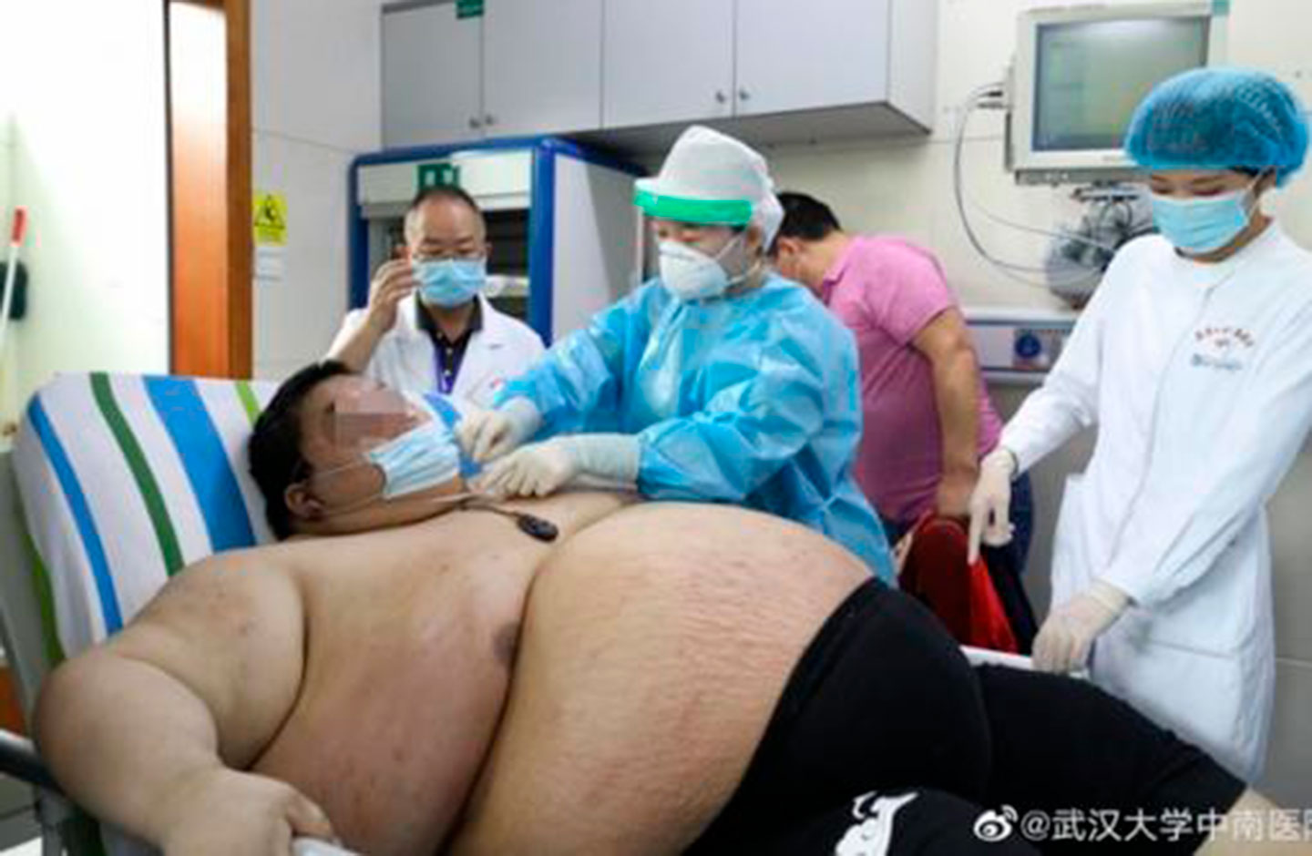 Hombre con sobrepeso en Wuhan