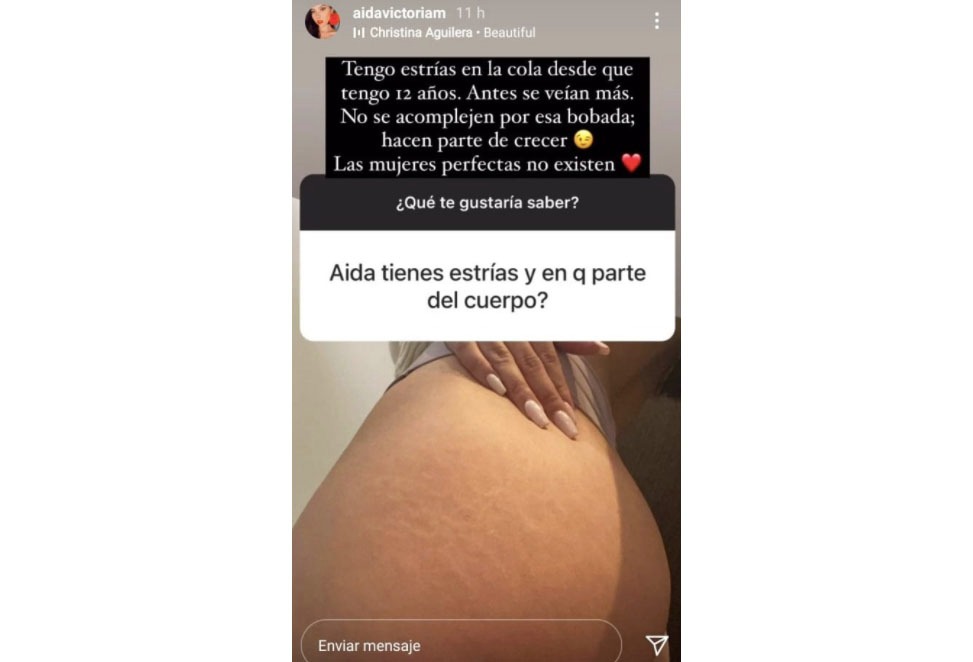 Estrías Aída Victoria