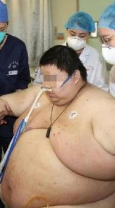 Hombre con sobrepeso atendido en Wuhan