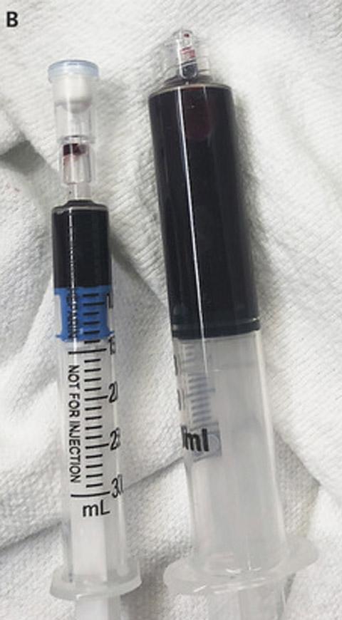 Resultado de imagen para mujer hospital sangre azul